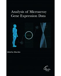 Analysis of Microarray Gene Expression Data